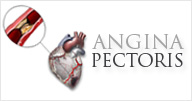 Angina - Norvist