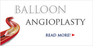 Balloon Angioplasty - Norvist