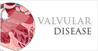 Valvular - Norvist